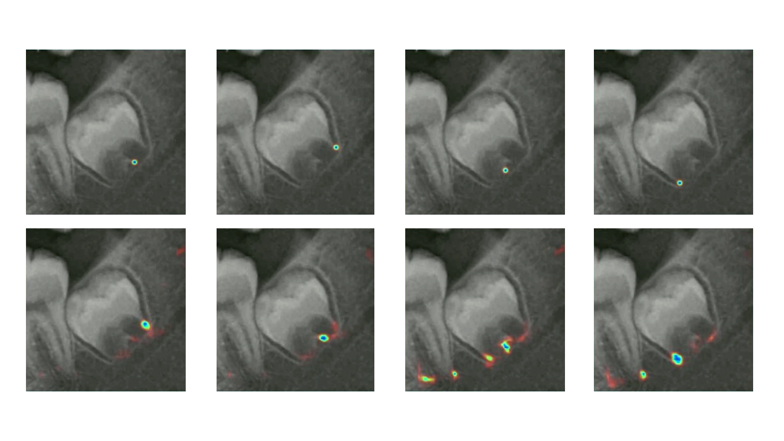 AI Integration in AGEstimation project